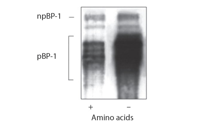 Figure 13. Effect of amino acids on IGFBP-1 phosphoisoforms release by cultured rat fetal liver cells