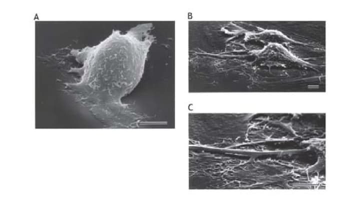 Figure 2. IGF-I-induced morphological changes in EVT cells (scanning electron microscopy)