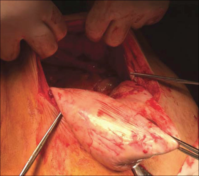 Figure 2. Intraoperative image