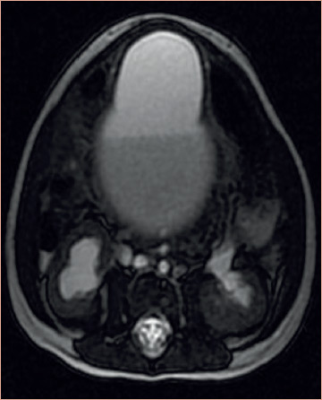 Figure 1: MRI Section