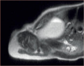 Figure 2: MRI Section