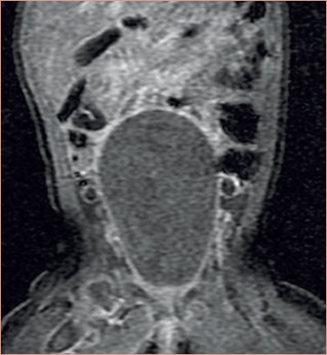 Figure 3: MRI Section